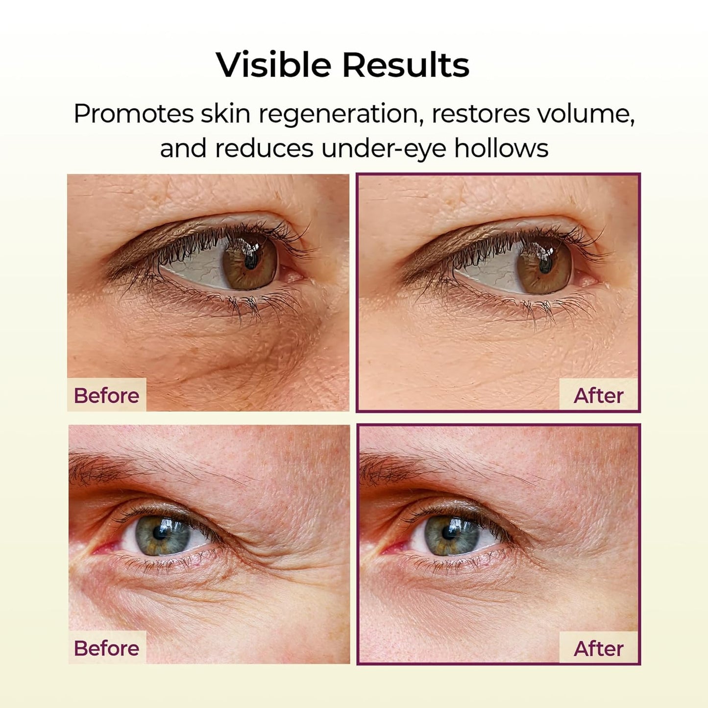 Cemenrete Calcium Volume Multi Balm - Πολυλειτουργικό Balm Σύσφιξης & Λάμψης