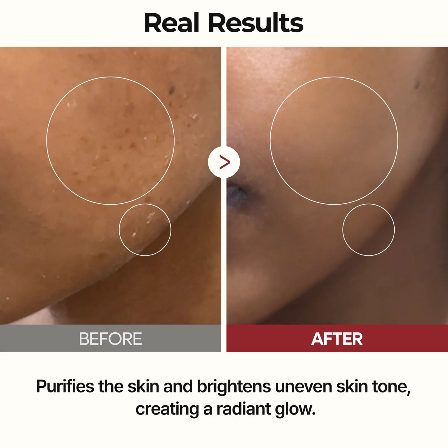 Peel Shot Glow Rice Toner - Τονωτική λοσιόν με εκχύλισμα ρυζιού