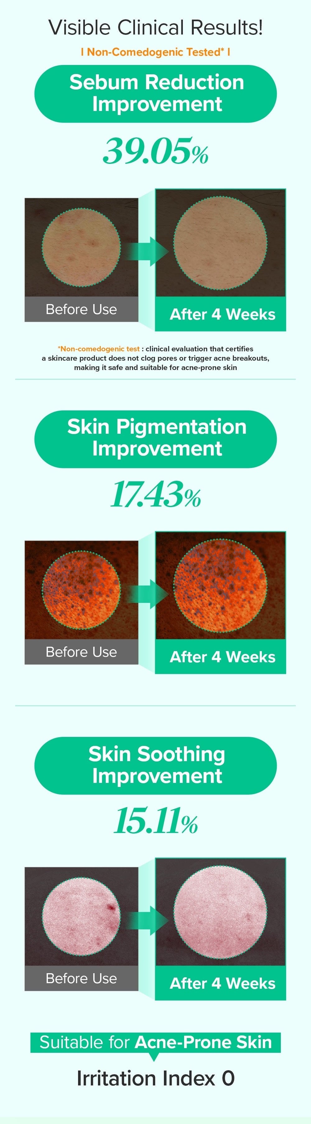 Spicule Azelaic PDRN Spot Cream