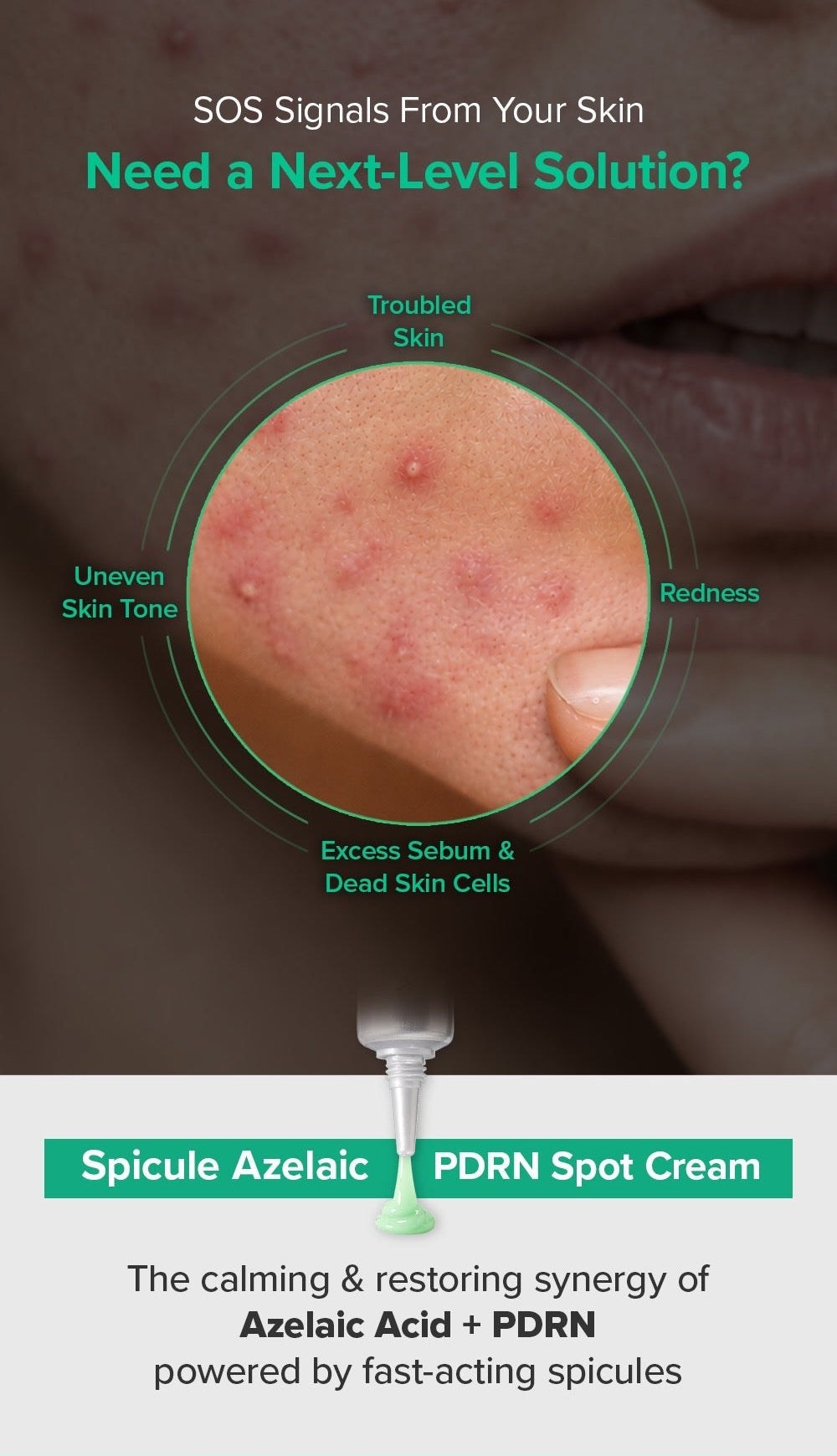 Spicule Azelaic PDRN Spot Cream