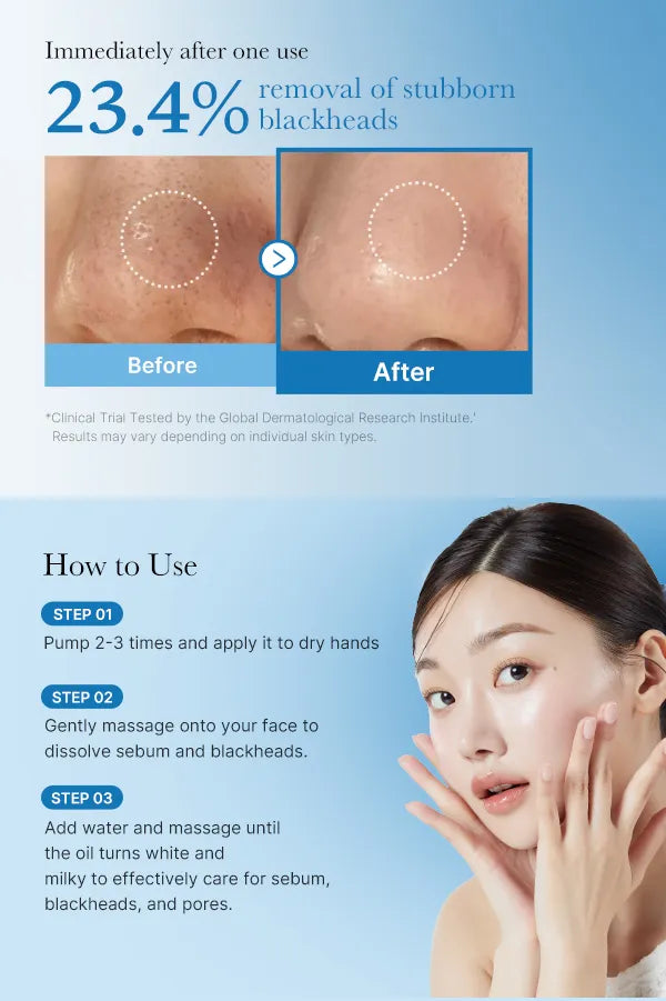 Zero Pore Blackhead Deep Cleansing Oil - Απαλό, βαθύ καθαριστικό λάδι για σμήγμα & μαύρα στίγματα