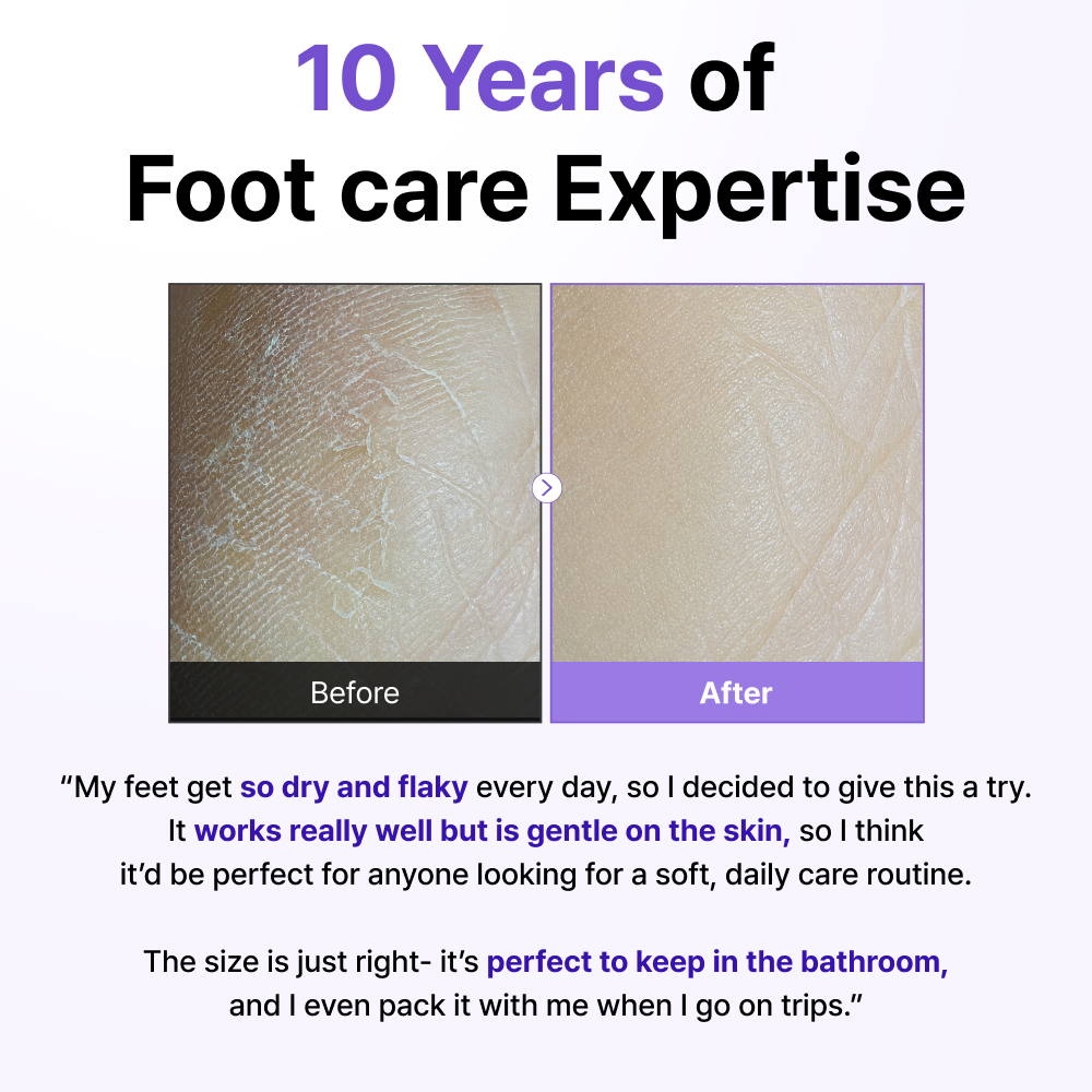 MagicGlass Stone Foot file - Γυάλινη Λίμα Ποδιών Διπλής Όψης για Κάλους & Σκληρύνσεις