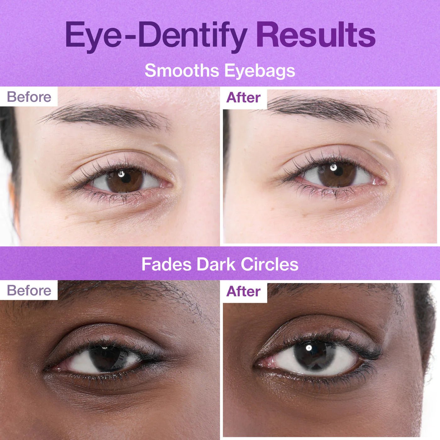 No.9 NAD Collagen Under Eye Patches